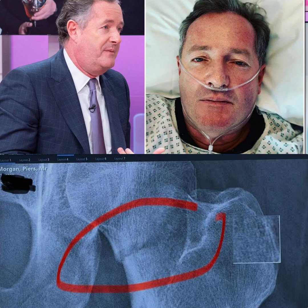 “It Was Pure Hell” — Piers Morgan Speaks Out After Devastating Fall Leaves Him Hospitalised, Broken, and Facing Months of Painful Recovery